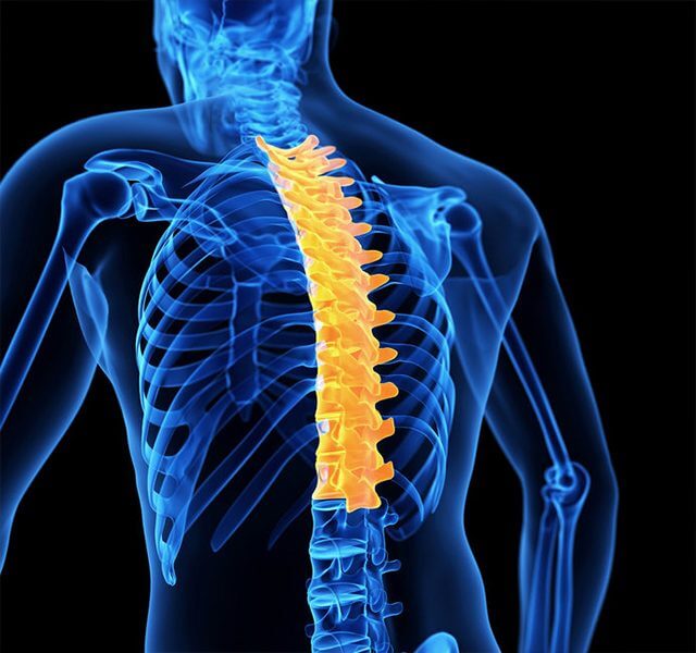 do bị thoái hoát đốt sống